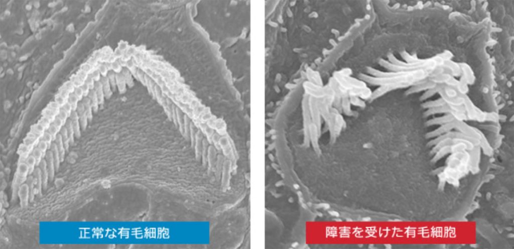 正常な有毛細胞・障害を受けた有毛細胞